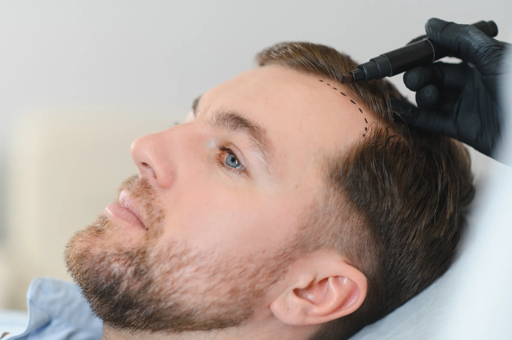 Peeling facial